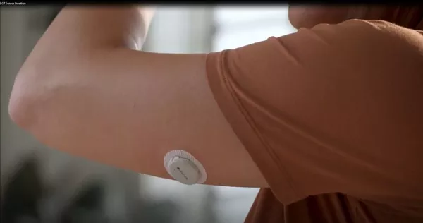 Dexcom G7 装着イメージ
